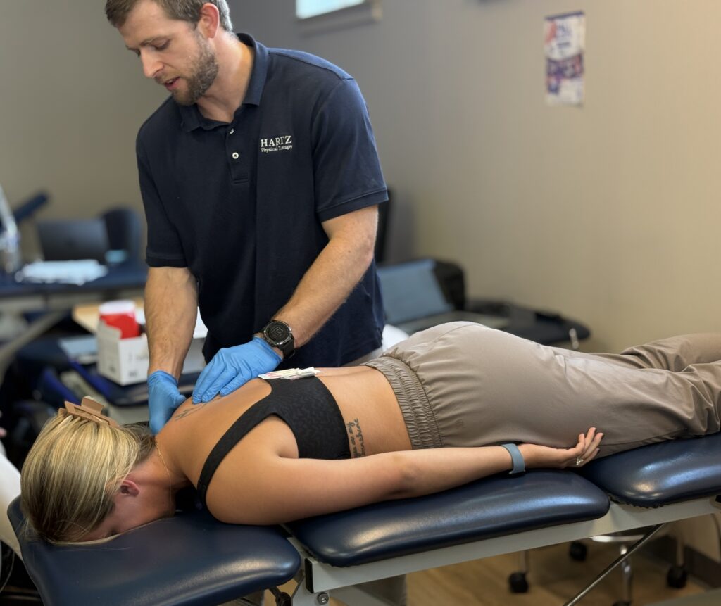 dry needling
